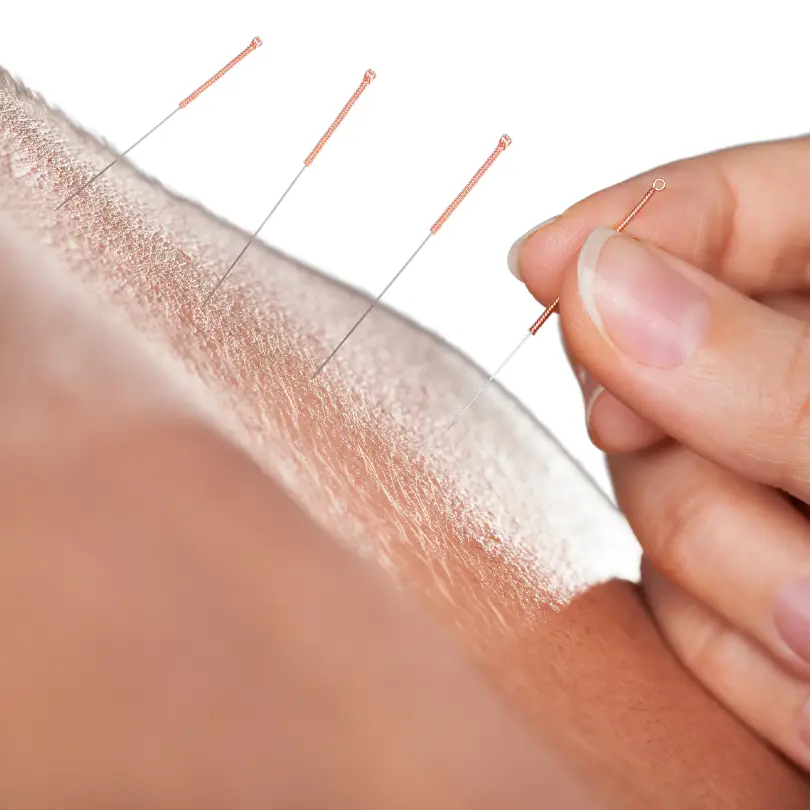 Agopuntura Linda Brigliadori – quadrato – 810×810 copia